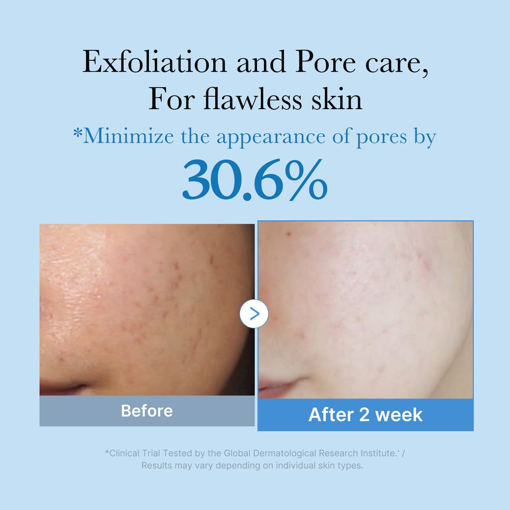 Zero Pore Toner - Fresh and Simple