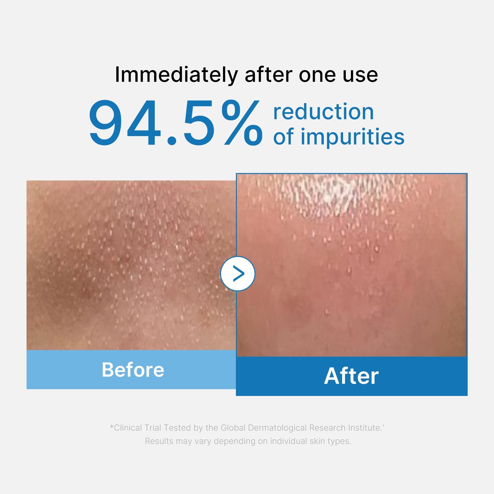 Zero Pore Blackhead Deep Cleansing Oil - Hydration Skin Pick