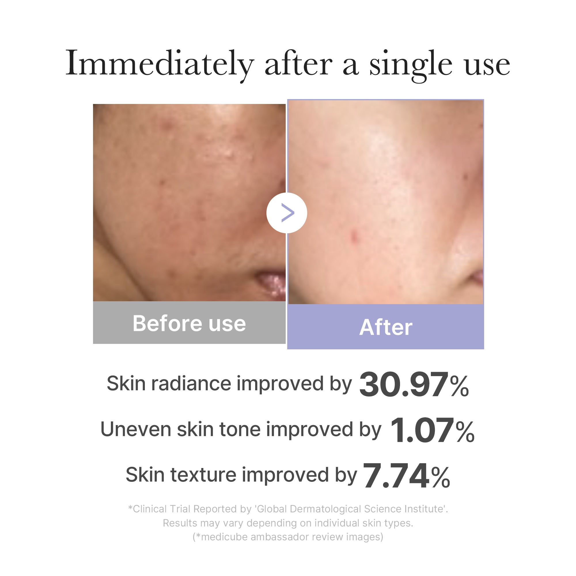Mini Booster Pro - Skincare Essential