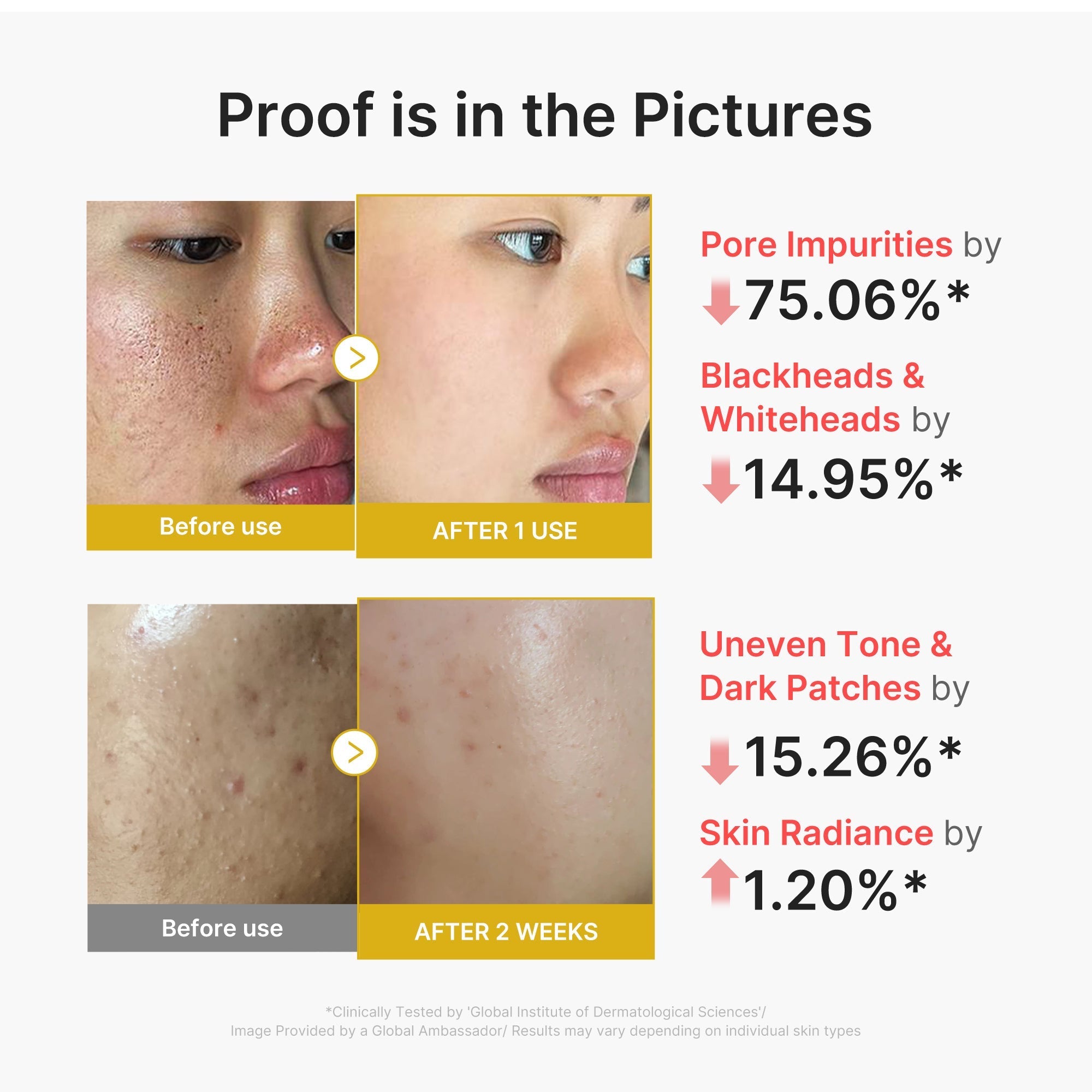 Kojic Acid Turmeric Peel Shot - Everyday K-Beauty