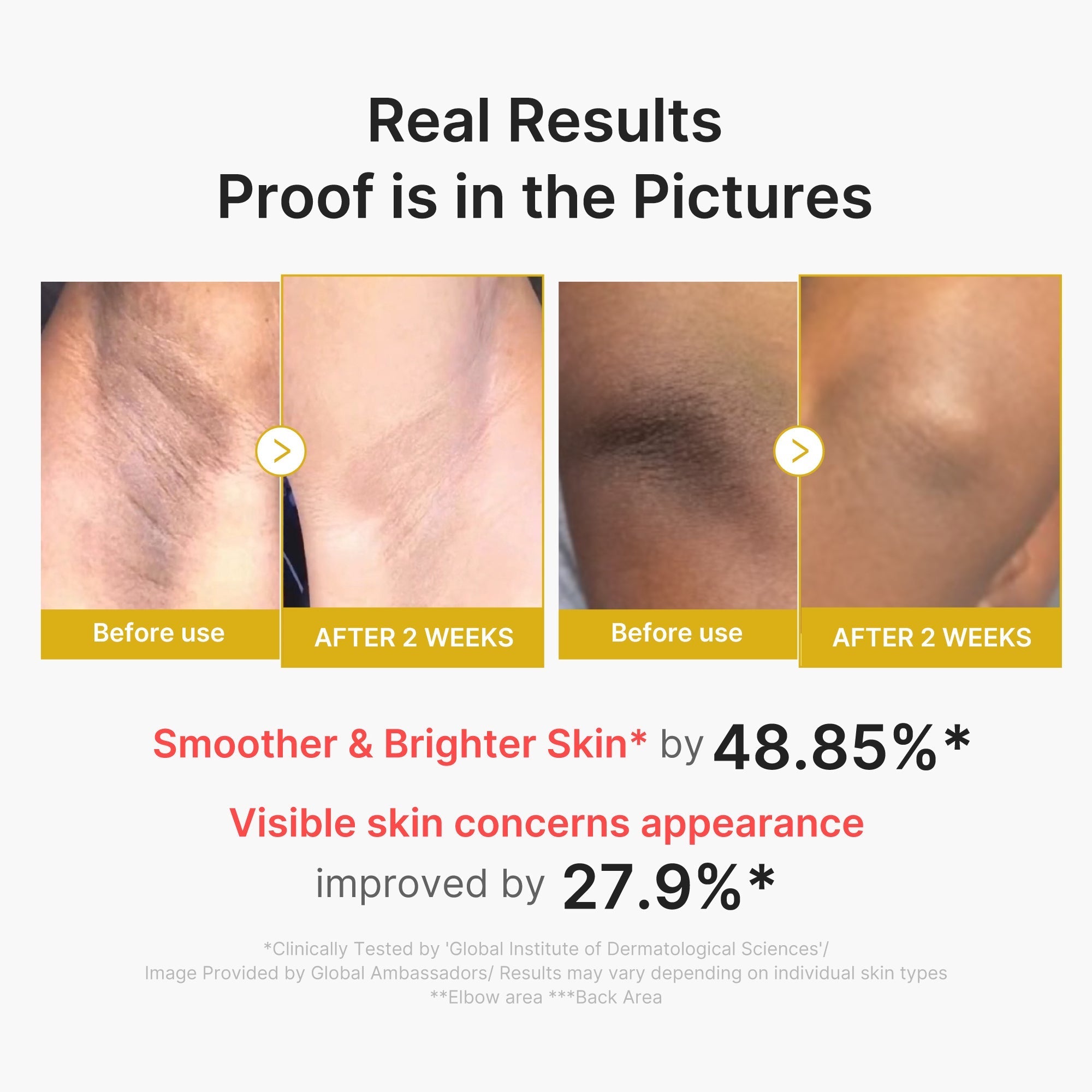 Kojic Acid Turmeric Body Peel Shot - Skincare for Daily Use