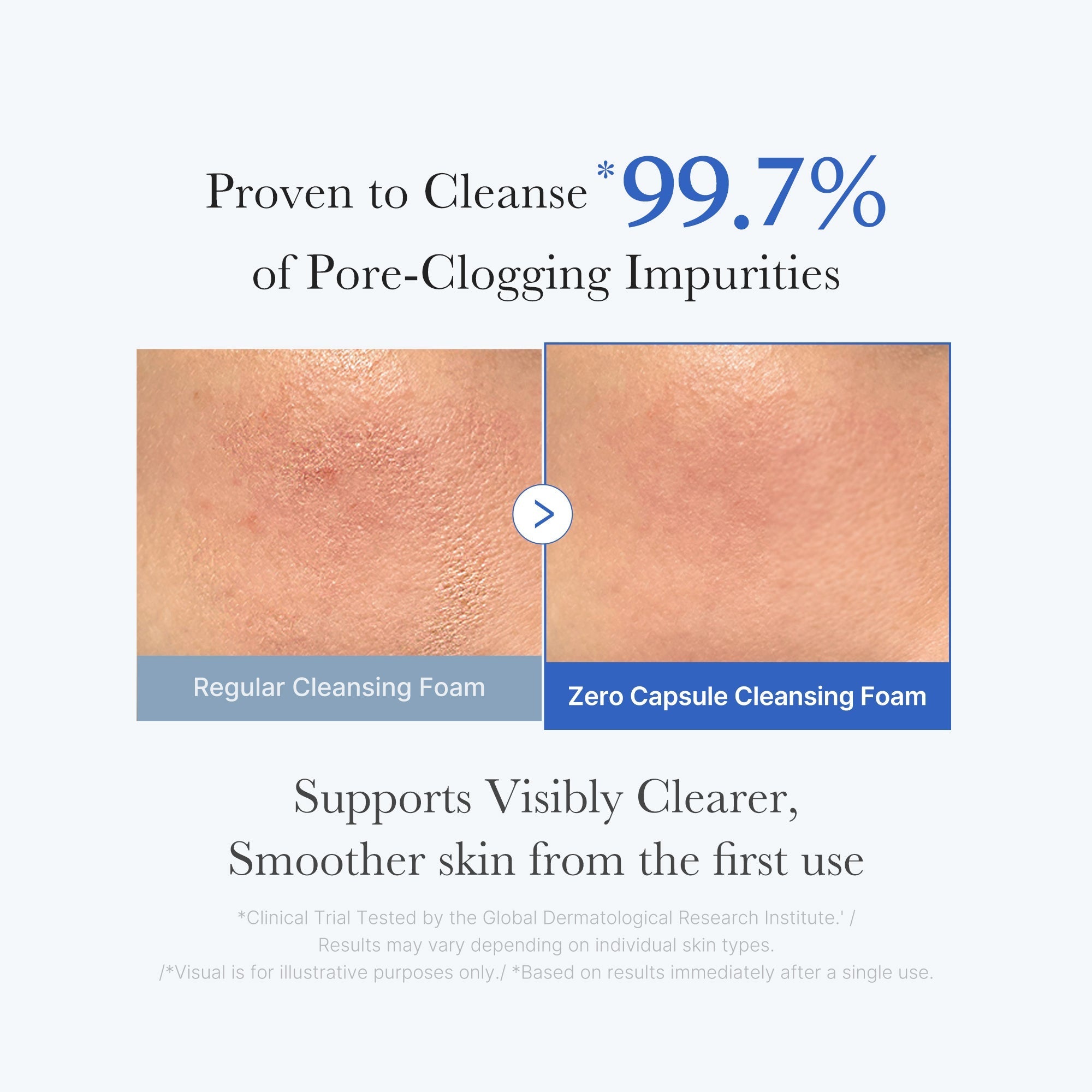 Zero Pore Capsule Cleansing Foam - Ready for Daily Glow