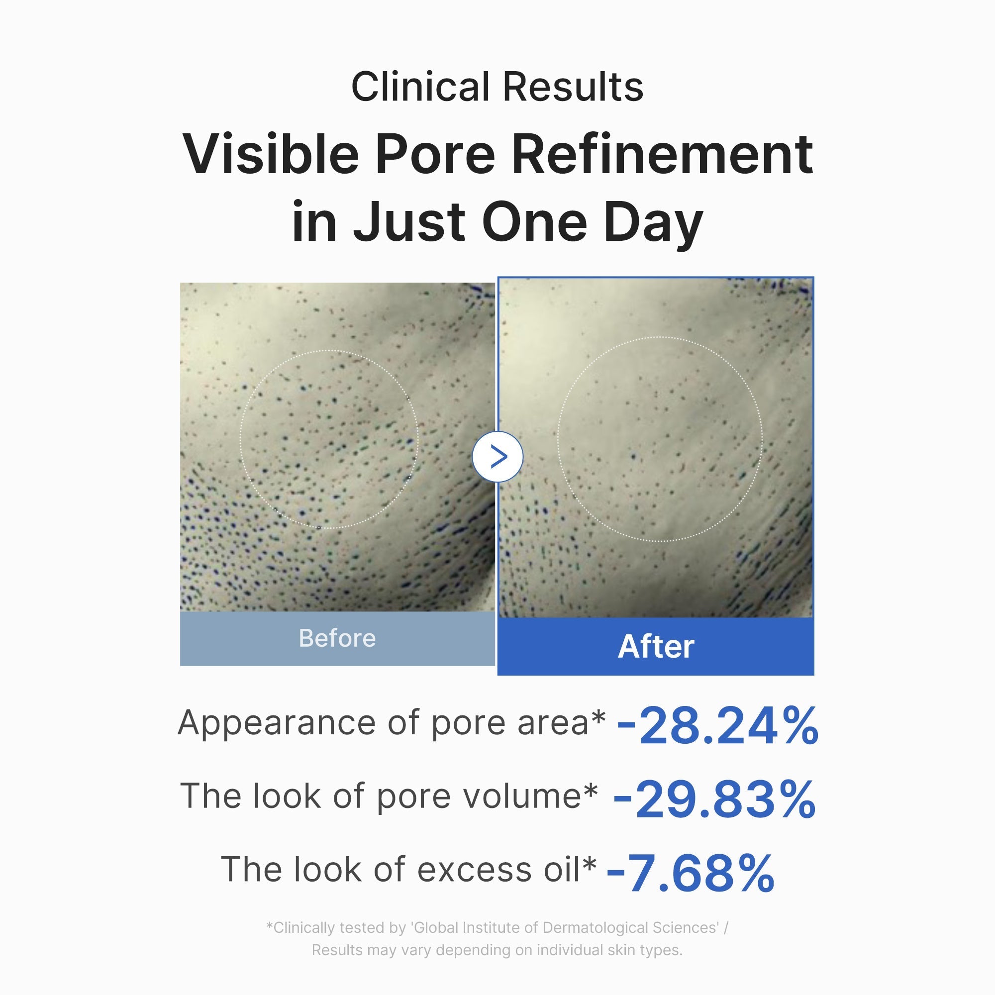 Zero Pore One-day Peptide Serum - Soft Skin Feel