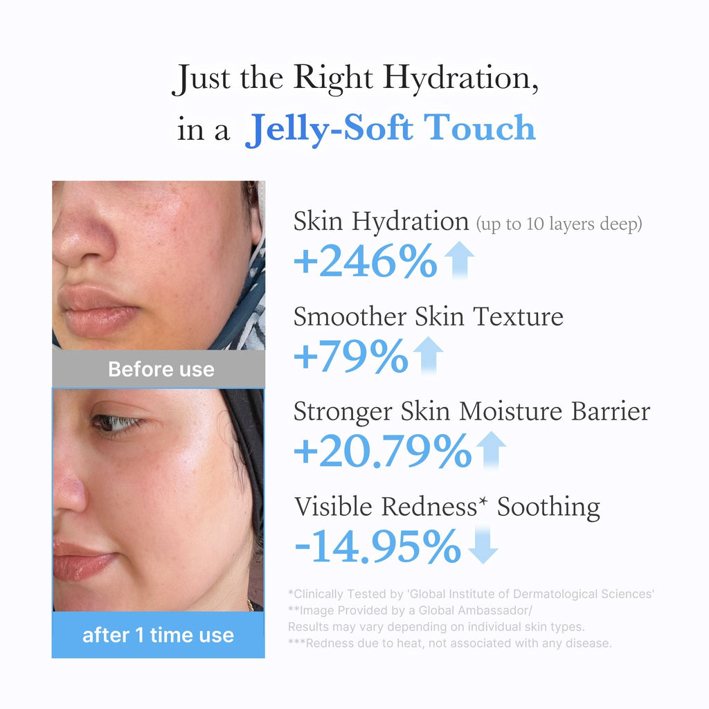 Hyaluronic Ceramide Moisturizing Jelly Cream - Fresh Face Daily
