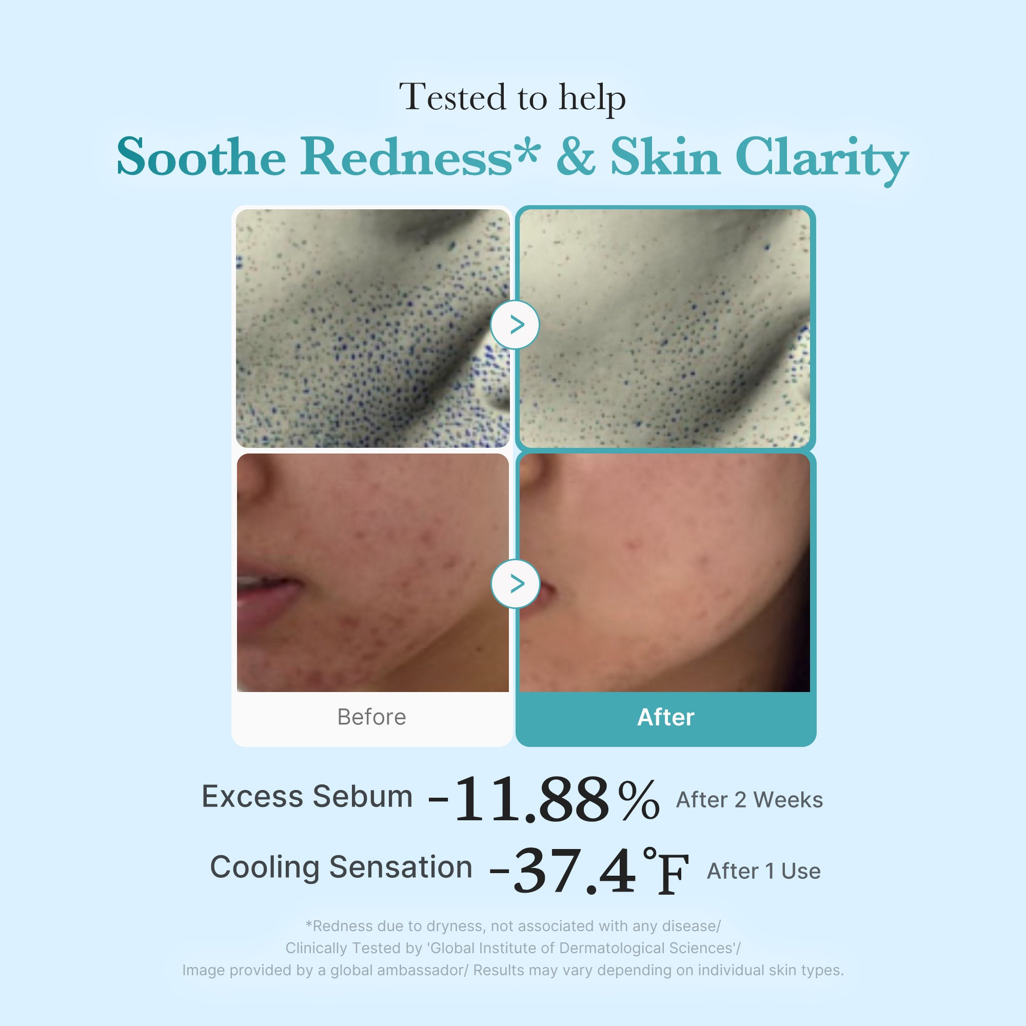 Azelaic Acid Niacinamide Clarifying Toner - Fresh Skin Favorites