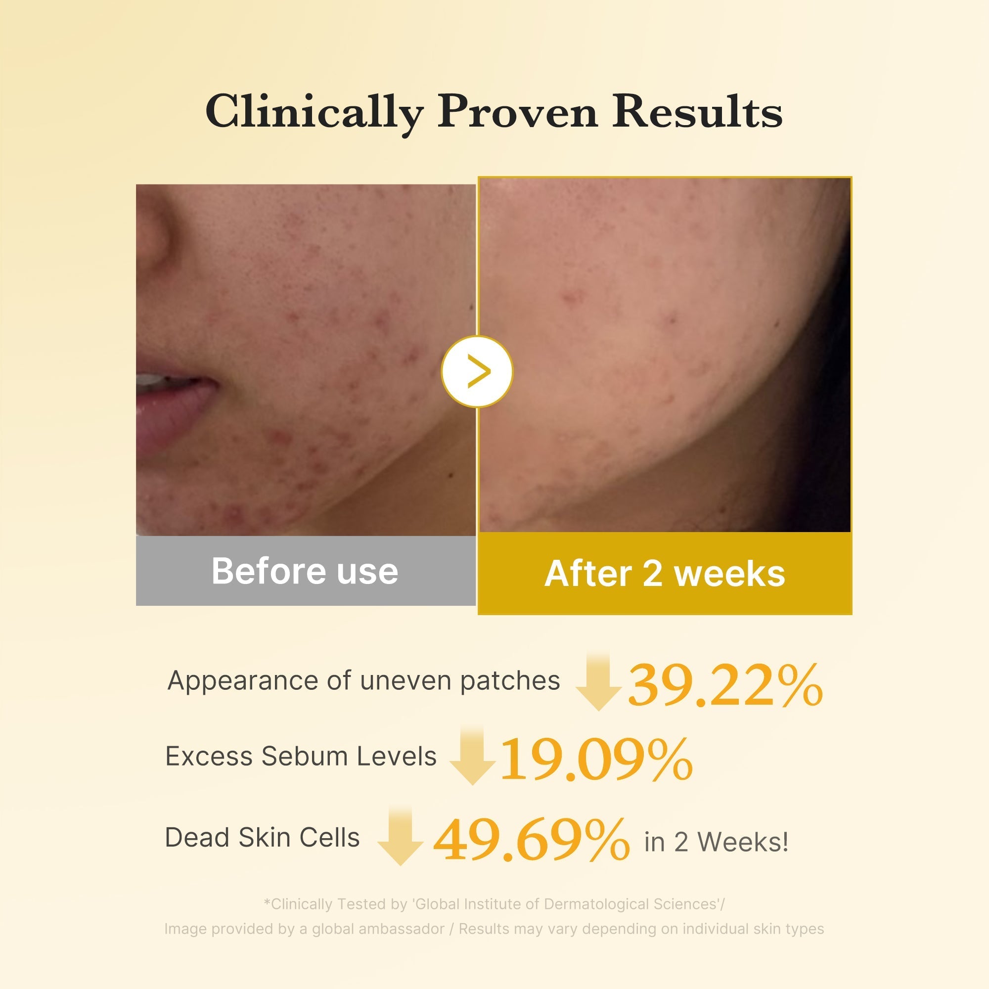Kojic Acid Tumeric Toner Pad - Skincare Essential