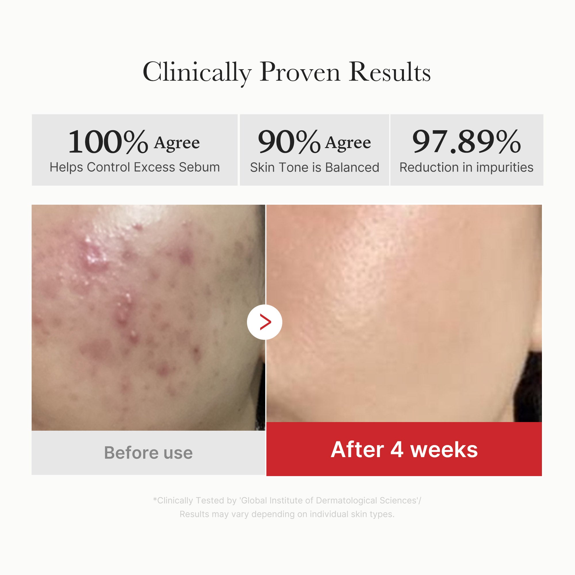 Red Succinic Acid Panthenol Pads - Fresh Skin Routine