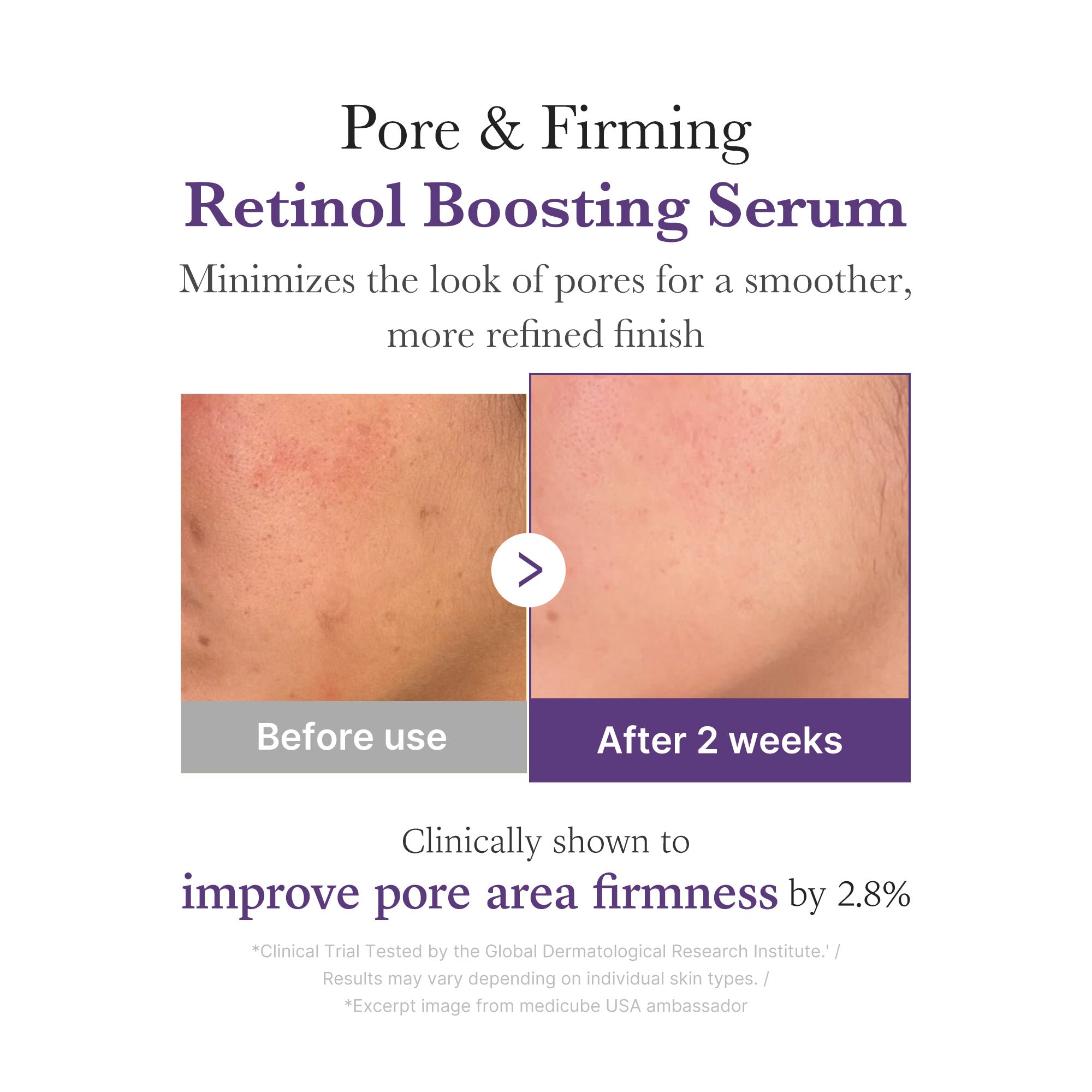 Retinol NMN Boosting Serum - Fresh Face Routine