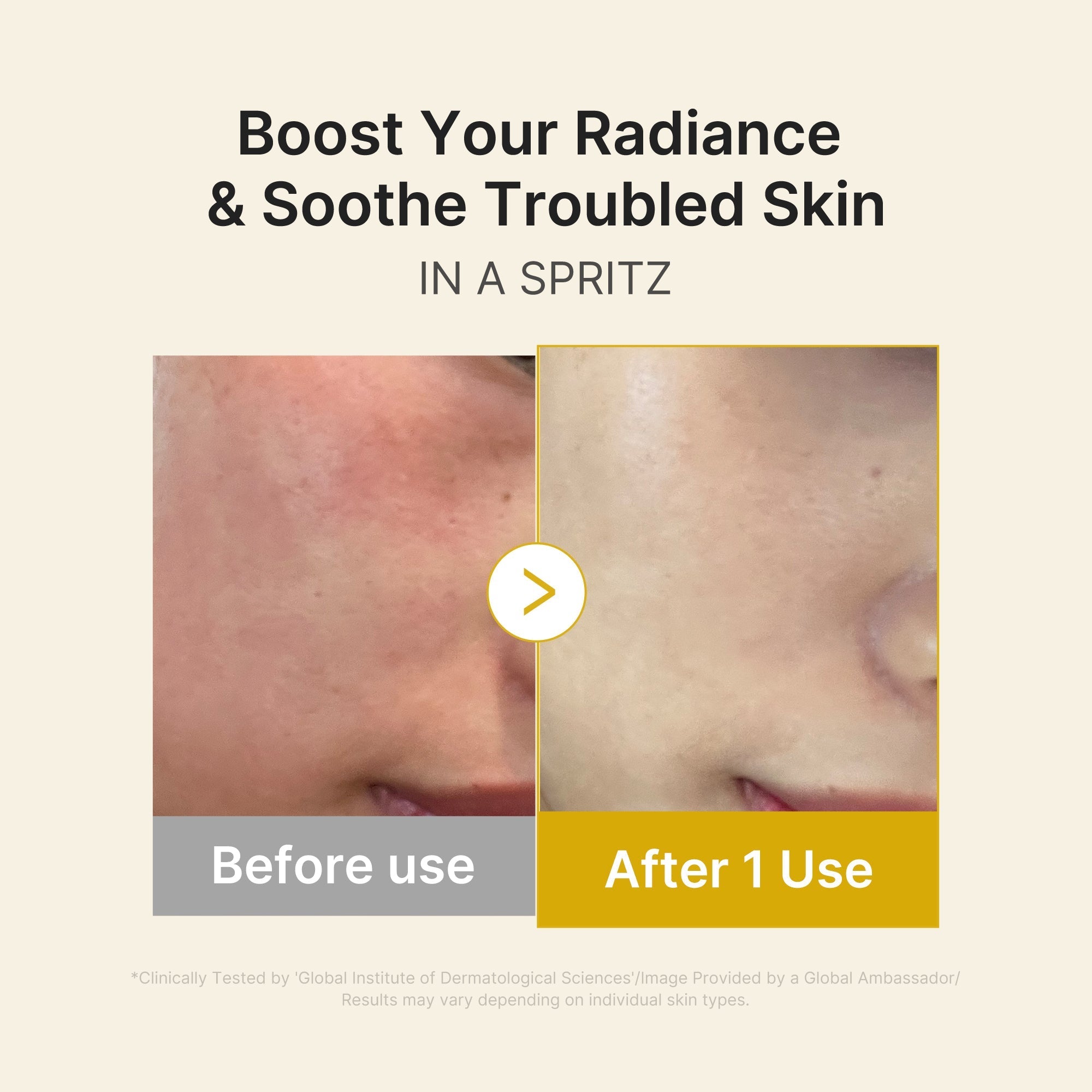 Kojic Acid Turmeric Vitamin Gold Jelly Mist Serum - Fresh Routine Essential