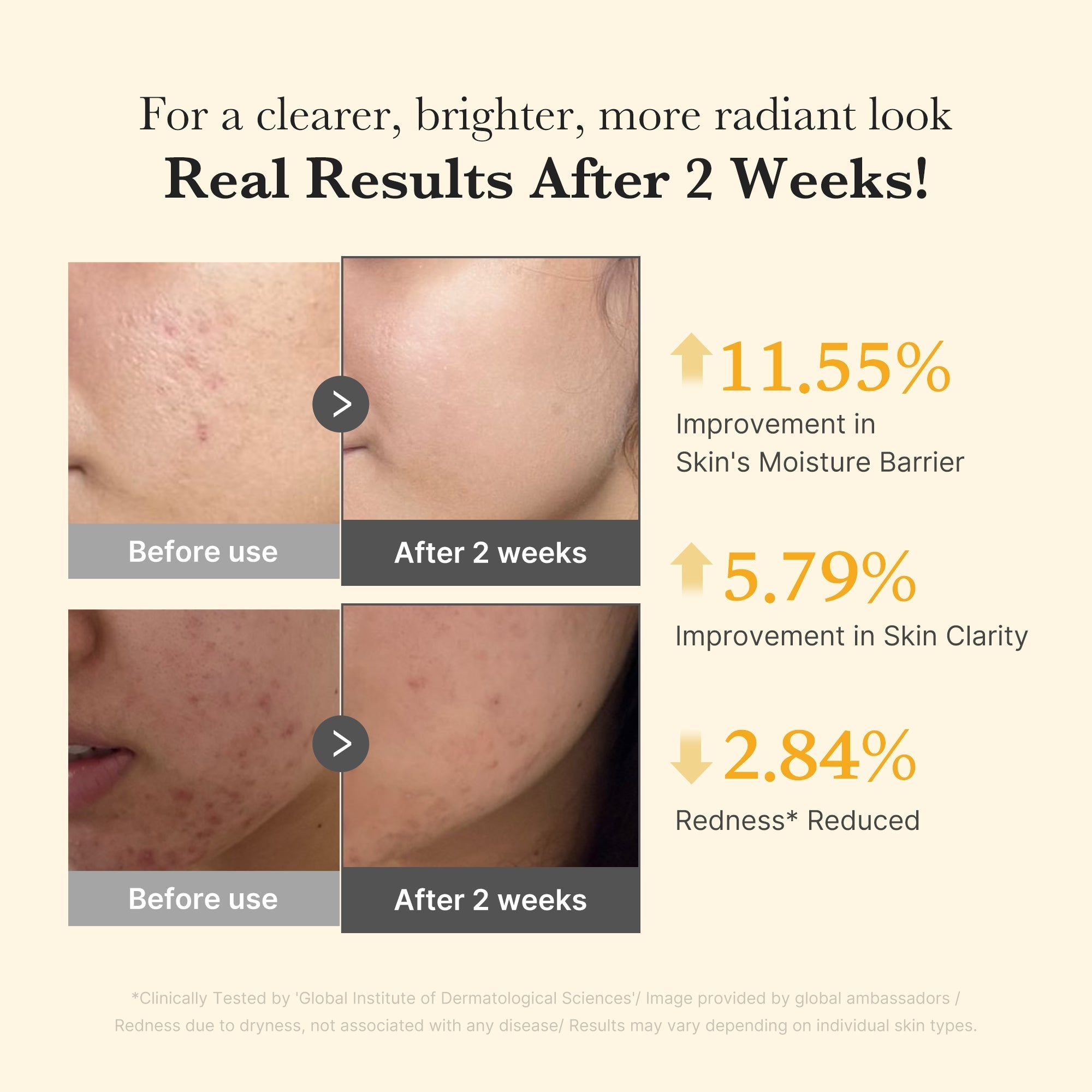 Kojic Acid Turmeric Capsule Serum - Ready for Your Routine