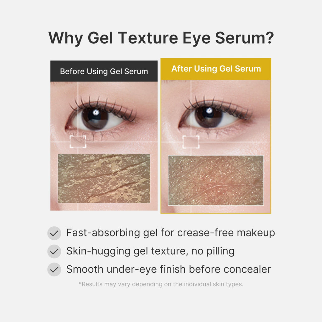 Kojic Acid Tumeric Eye Gel Serum - Glow Routine Essential