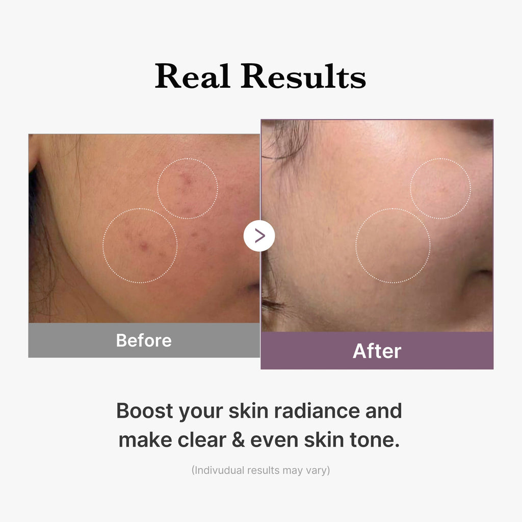 AGE-R Glutathione Glow Milk Toner - Glow Skin Pick