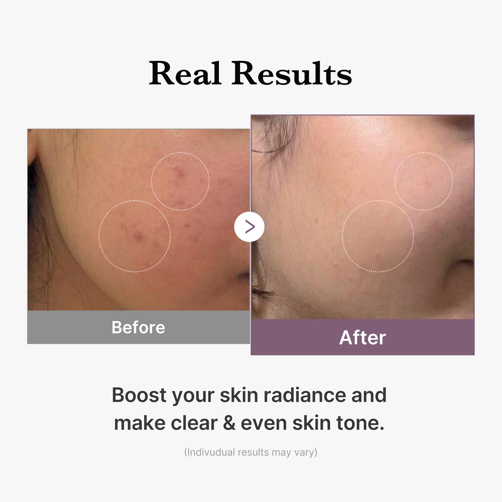 AGE-R Glutathione Glow Milk Toner - Glow Skin Pick