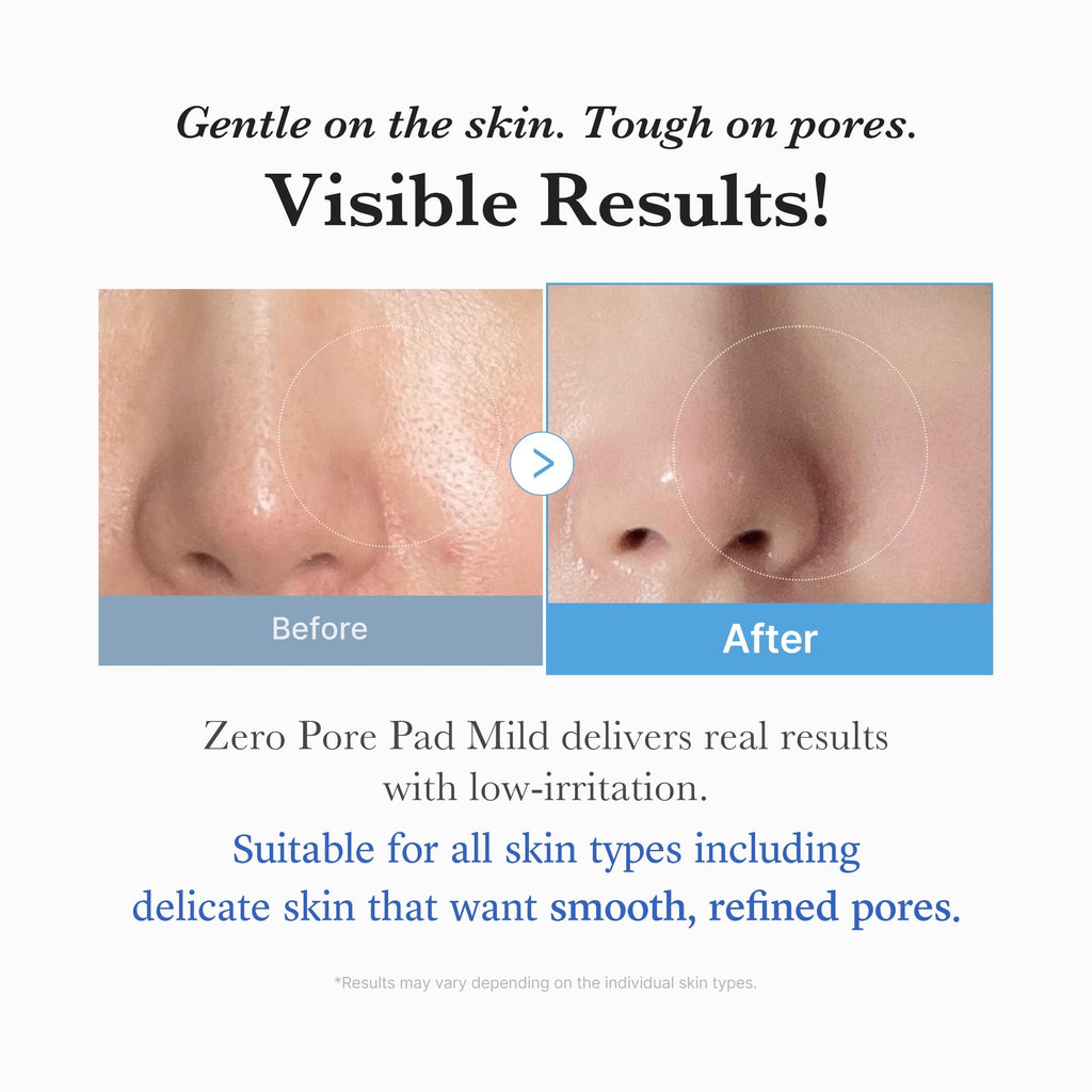 Zero Pore Madecassoside Pads (Mild) - Made for Fresh Skin