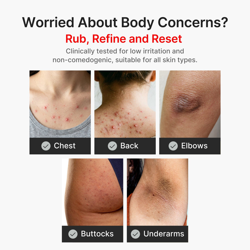 Kojic Acid Turmeric Body Peel Shot - Skincare for Daily Use