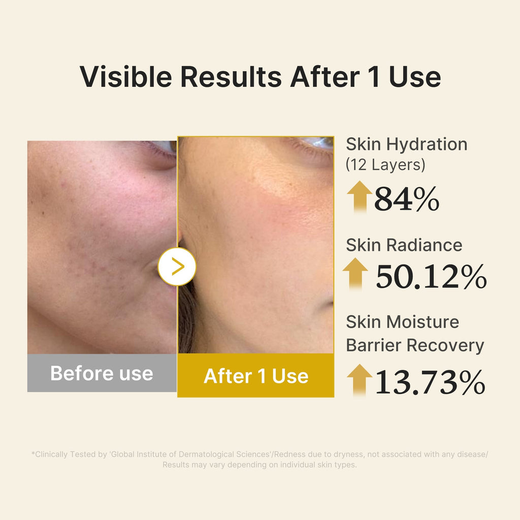 Kojic Acid Turmeric Vitamin Gold Jelly Mist Serum - Fresh Routine Essential