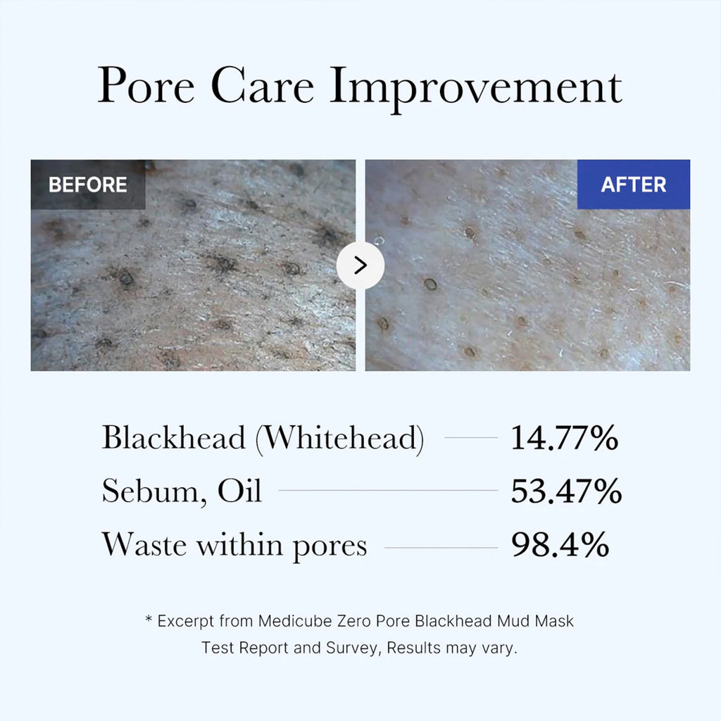 Zero Pore Blackhead Mud Mask - Made for Daily Glow
