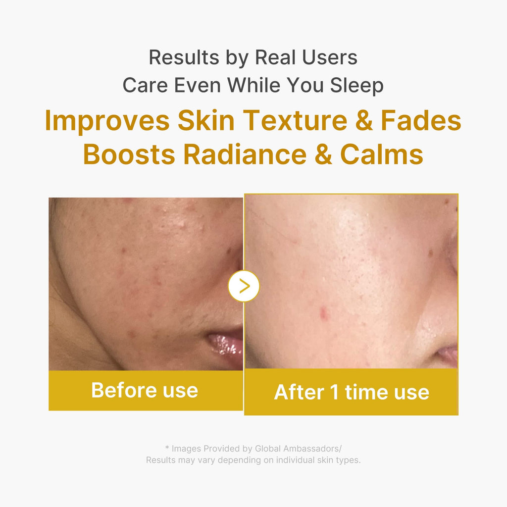 Kojic Acid Turmeric Overnight Wrapping Mask - Your K-Beauty Pick
