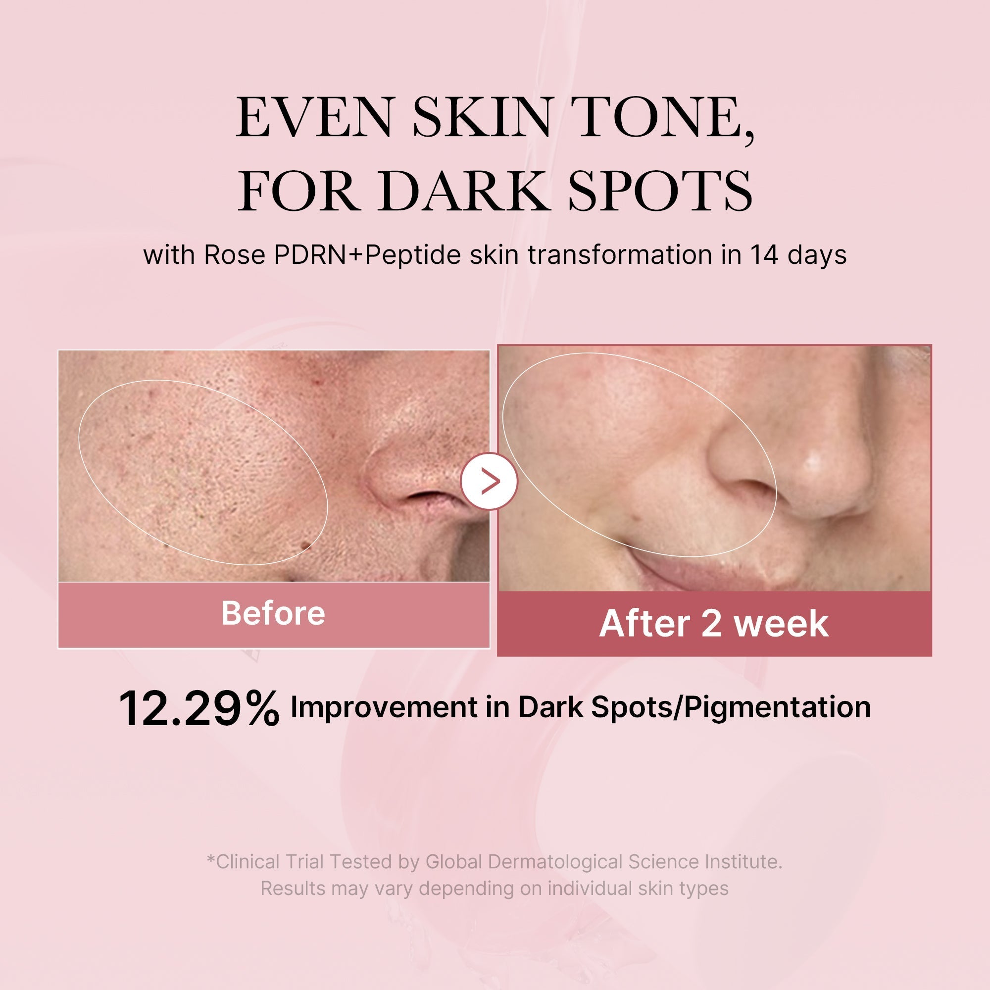 PDRN Pink Peptide Toner - Made for Skin Care