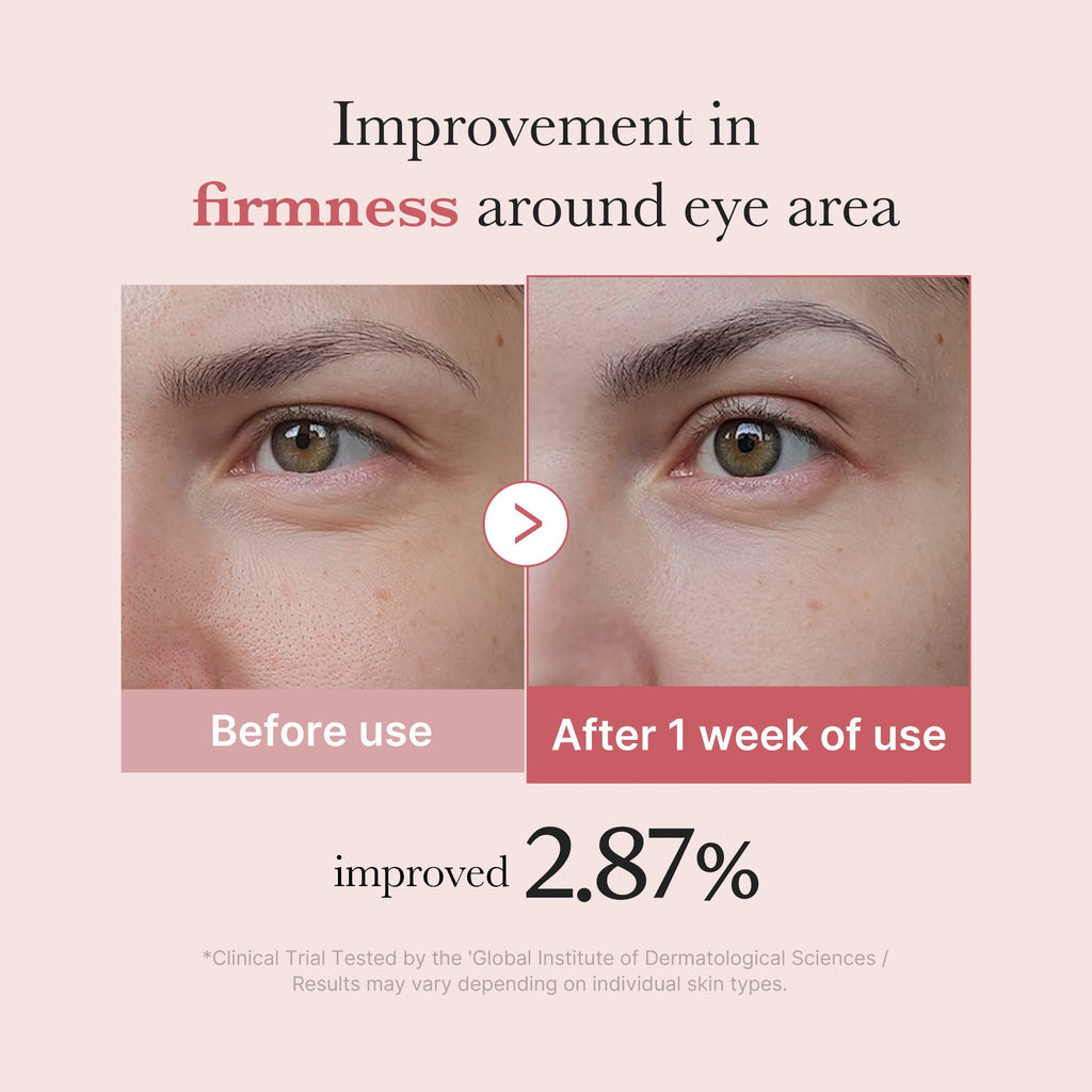 PDRN Pink Peptide Eye Cream - Fresh Face Daily