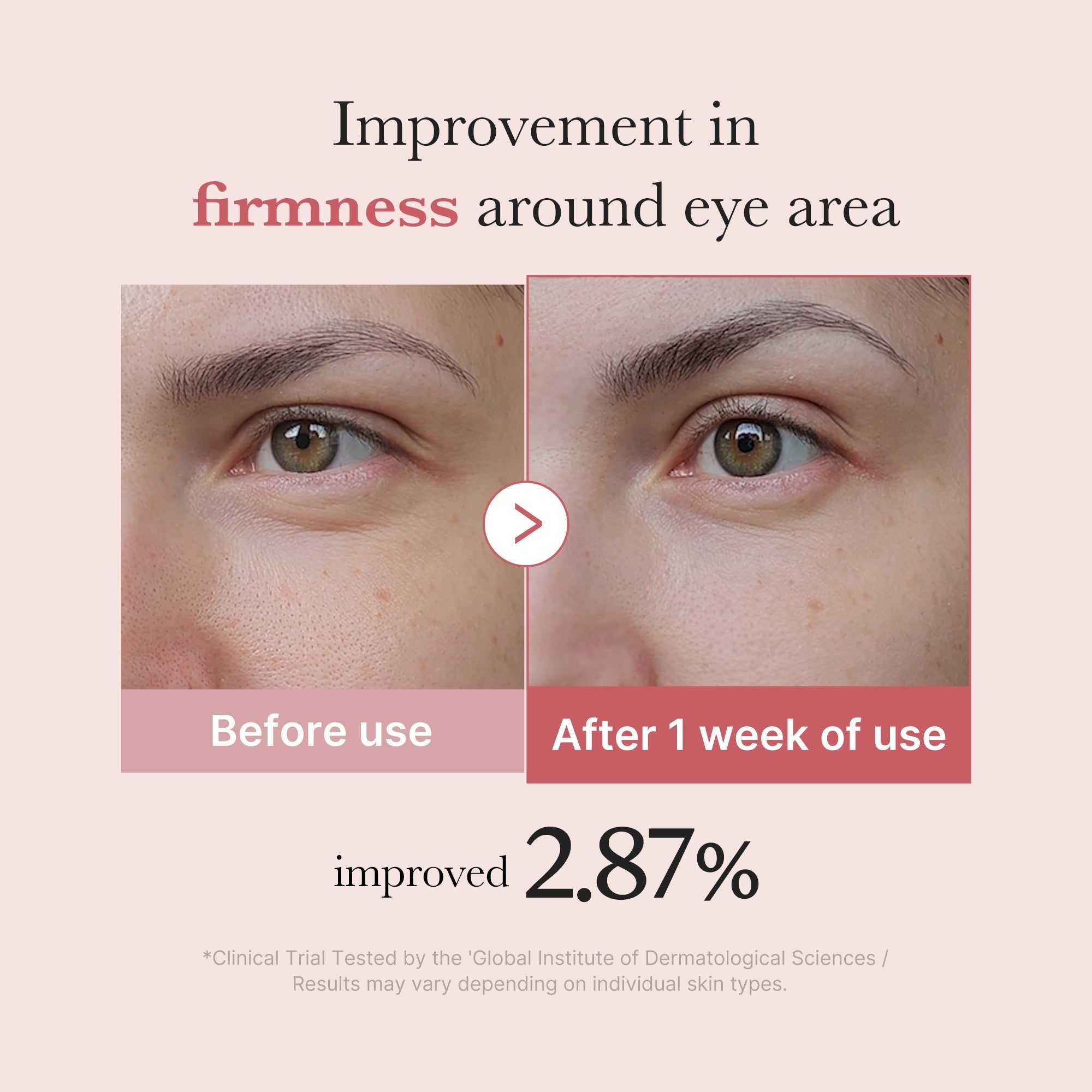 PDRN Pink Peptide Eye Cream - Fresh Face Daily