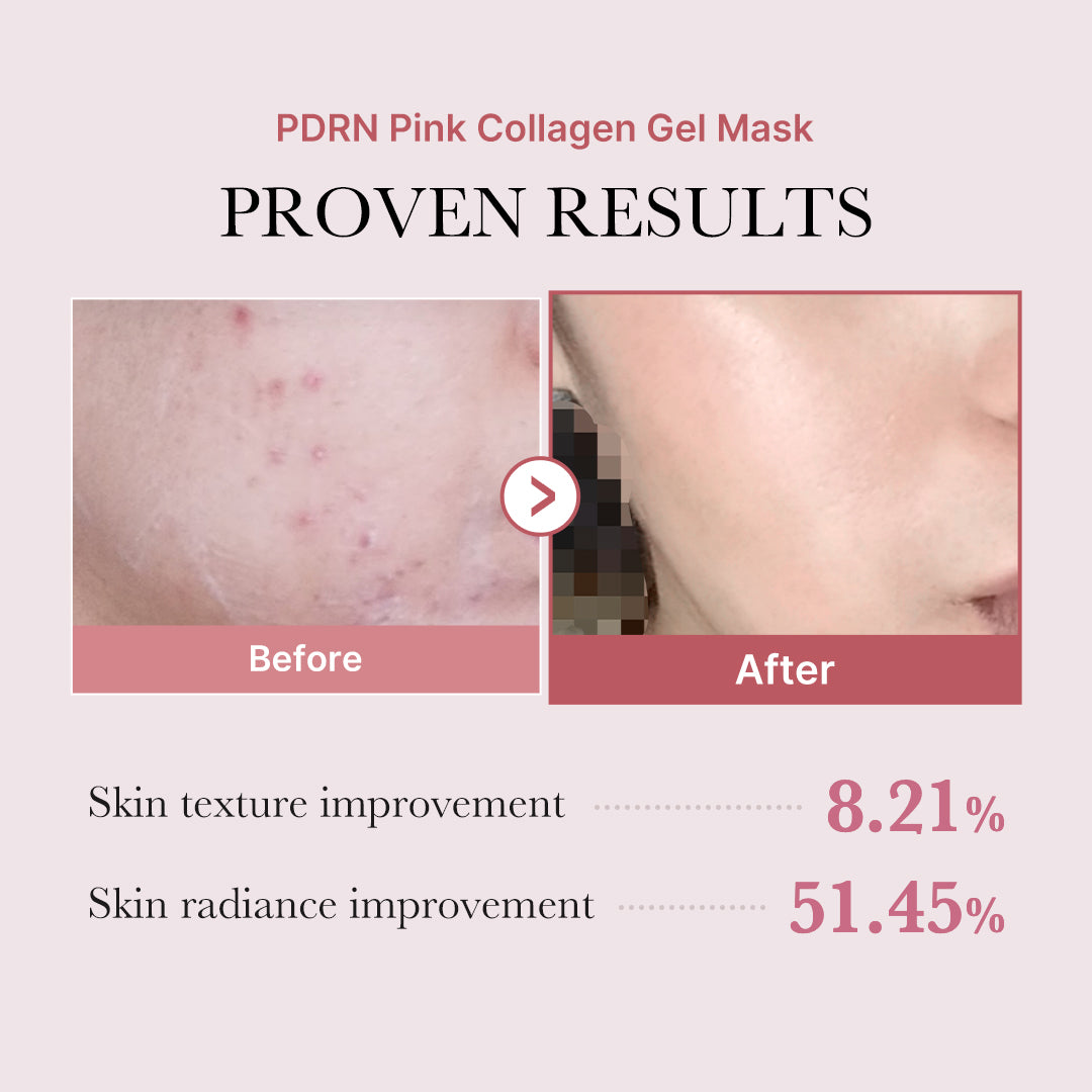 Salmon PDRN Pink Collagen Jelly Gel Mask - Your Everyday Routine