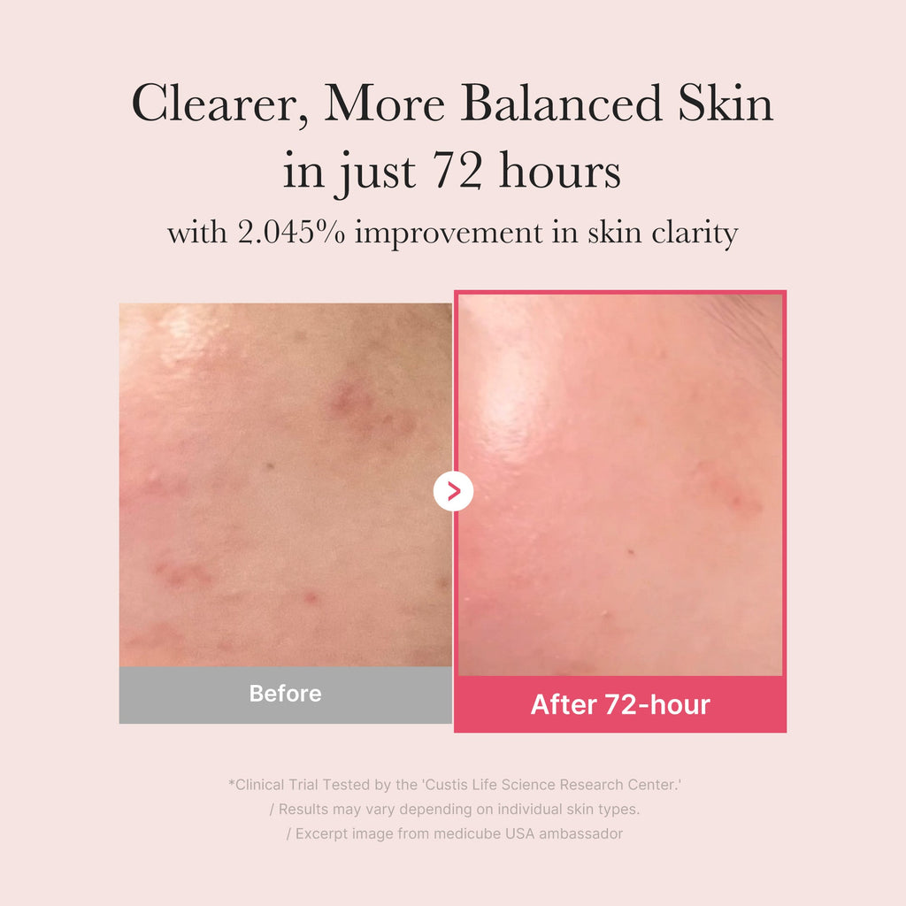 testtesttest - Ready for Fresh Skin