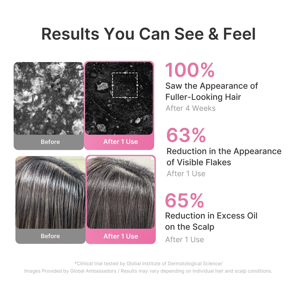Rosemary PDRN Cooling Thickening Shampoo - Routine Made Easy