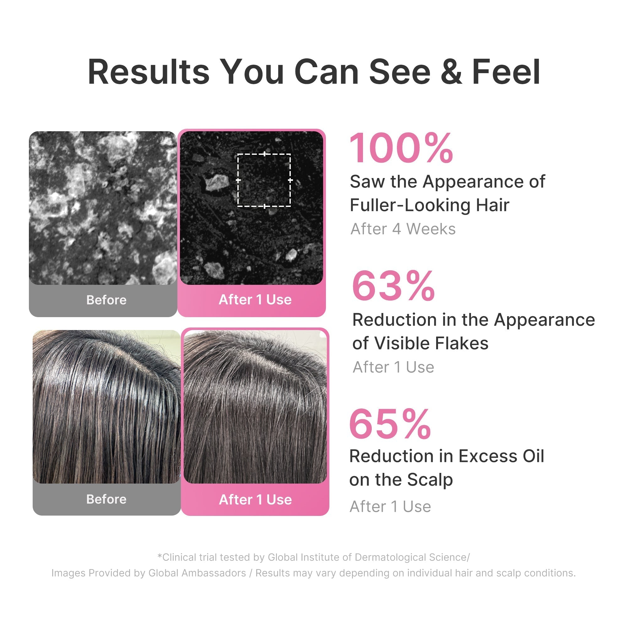 Rosemary PDRN Cooling Thickening Shampoo - Routine Made Easy