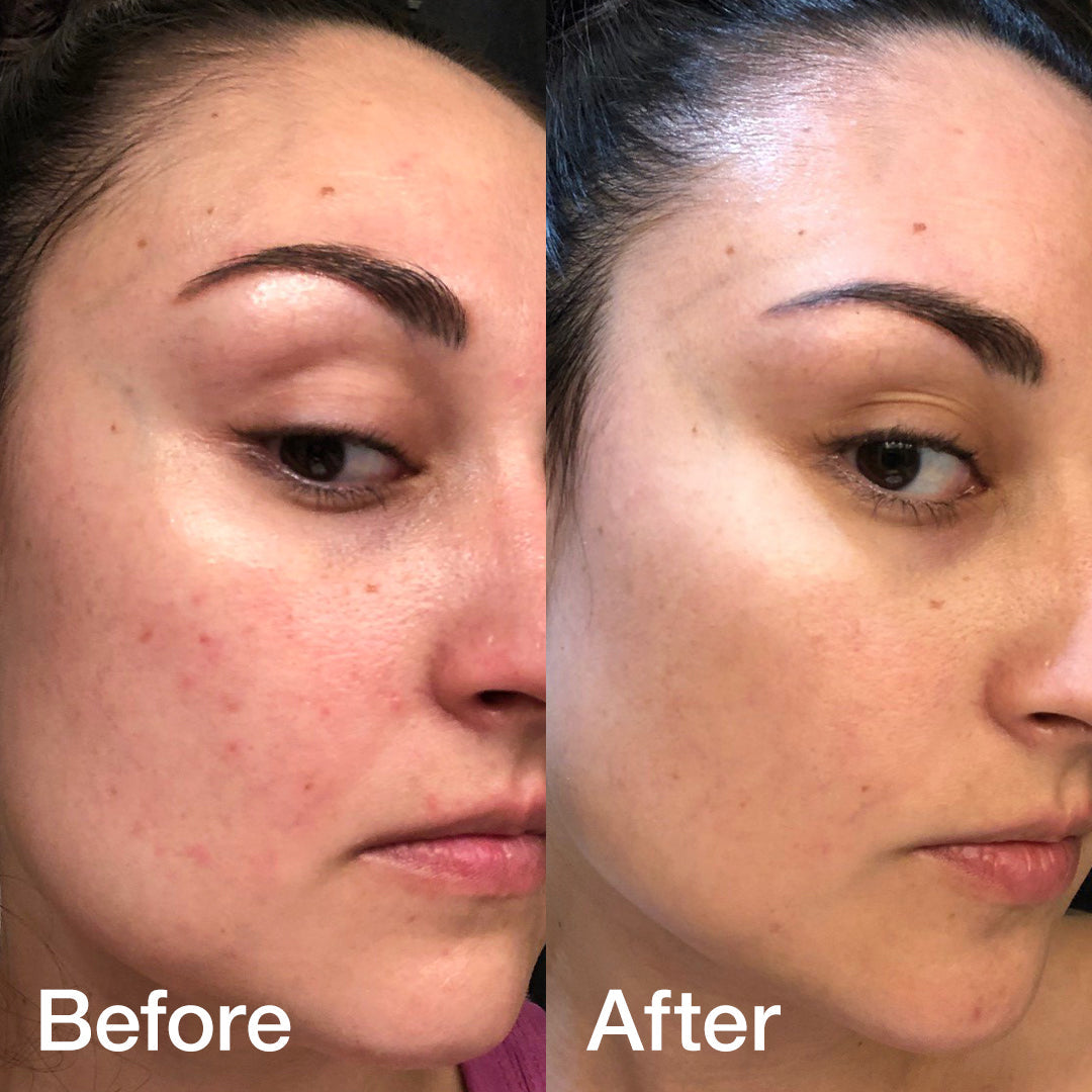 Glass Glow Duo - Simple Beauty Care