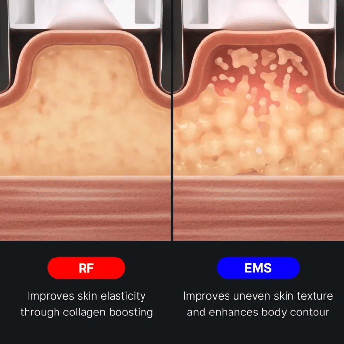 AGE-R Contour Body Shot - Smooth Skin Routine